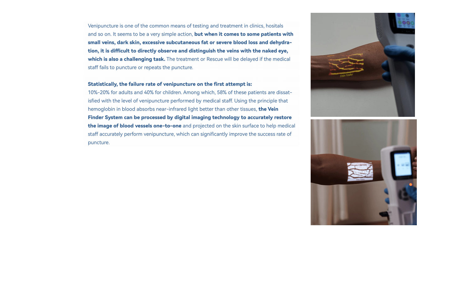 Optical Coherence Tomography Angiography