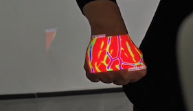 نصائح لاستخدام جهاز Vein Finder لسحب الدم بنجاح