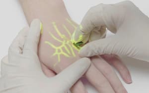 تخفيف رهاب الإبر: كيف تساعد تقنية تحديد الأوردة المرضى القلقين؟