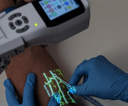 كيف يمكن لأجهزة تصوير الأوردة المحمولة أن تساعد في جمع الدم من منزل إلى منزل؟