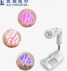 ما هي النقاط الأربع الرئيسية التي يجب على Vein Finder الانتباه إليها؟