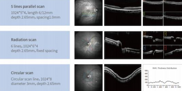 الذكاء الاصطناعي + التصوير المقطعي البصري: كيف يمكن للذكاء الاصطناعي أن يساعد أطباء العيون على التشخيص بشكل أسرع وأكثر دقة؟