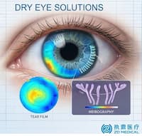 تعزيز رعاية سطح العين من خلال حل جفاف العين المتكامل من ZD Medical